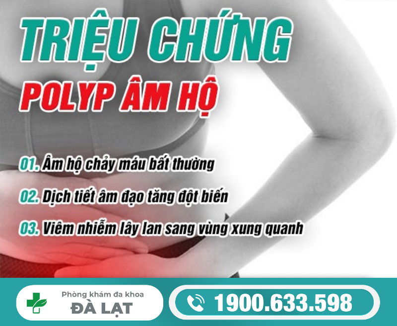 Hình ảnh minh họa